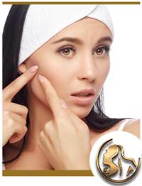 Acne Treatments Near Me in Encino, CA