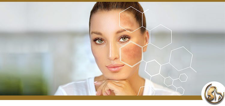 Hyperpigmentation Treatment Near Me in Encino, CA