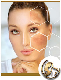Hyperpigmentation Specialist Near Me in Encino, CA