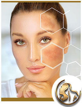 Hyperpigmentation Specialist Near Me in Encino, CA