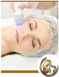 Microdermabrasion Near Me in Encino, CA