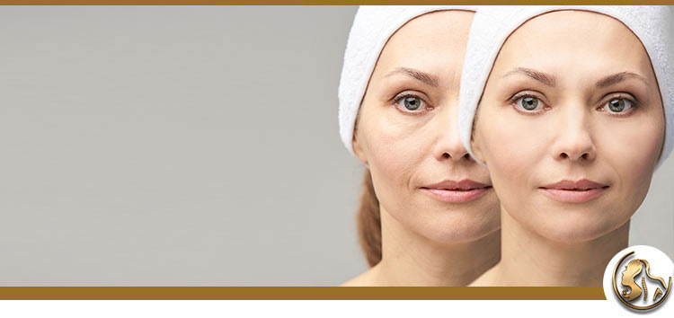 Under Eye Filler Specialist Near Me in Encino, CA