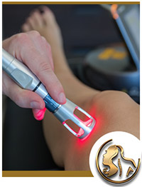 Laser Therapy Near Me in Encino, CA