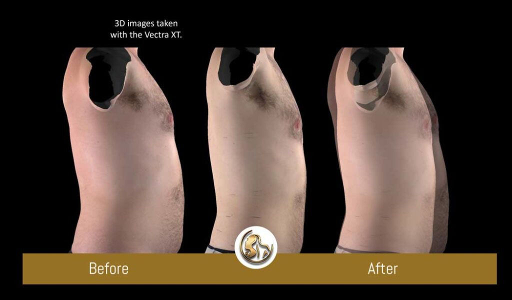 UltraSlim UltraSlim