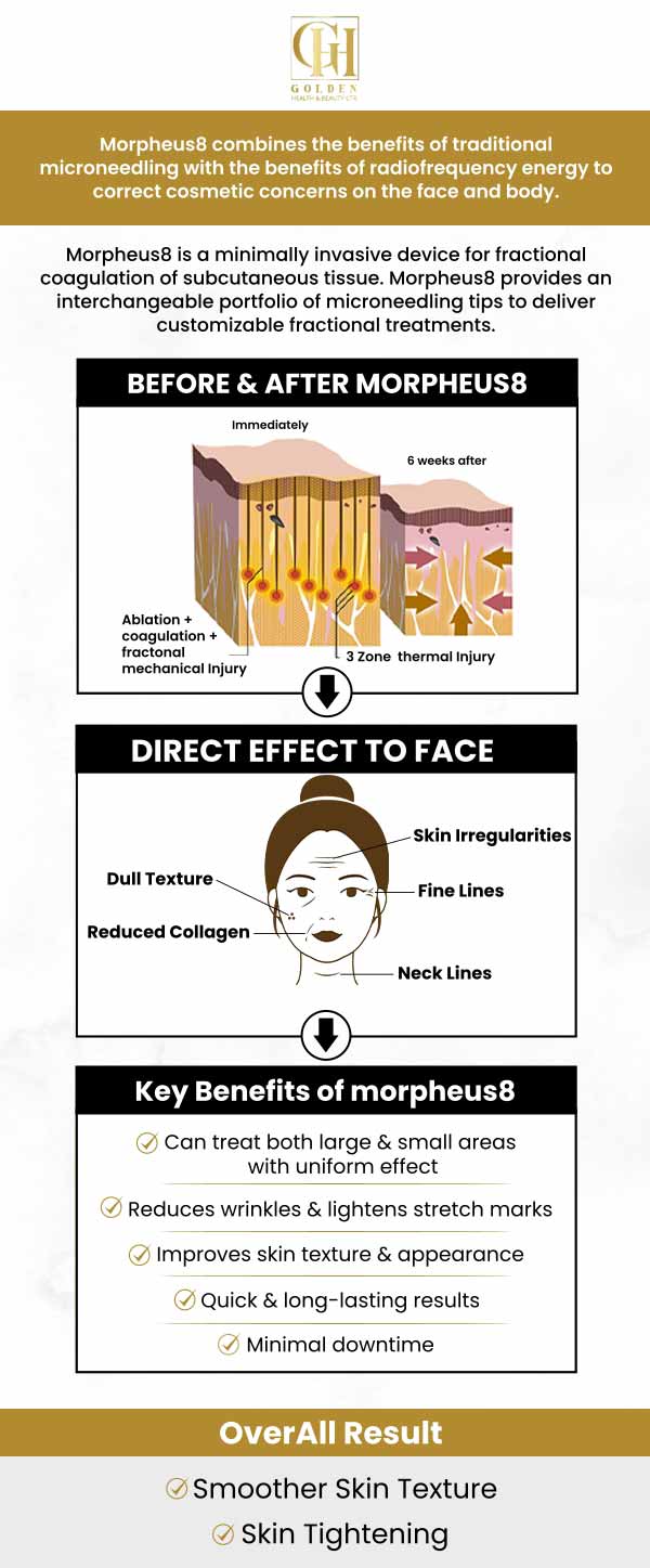 Do you have sagging skin, wrinkles, or fine lines? Dr. Pantea Nikaeen at Golden Health & Beauty Center provides the non-invasive morpheus8 procedure to rejuvenate your skin, which is suitable for all skin types who want to reduce the signs of aging. Morpheus8 can be used to treat various body parts, including the neck, arms, knees, belly, and nasolabial fold lines. This treatment helps to reduce acne scars, tighten loose skin, produce more collagen, and get rid of stretch marks. Contact us for more information and book an appointment online. We are conveniently located at 16661 Ventura Blvd #700, Encino, CA 91436.