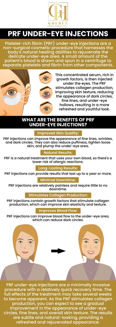 Under-eye fillers are an aesthetic procedure that treats hollows under the eyes and dark circles. The benefits include quick outcomes, minimum downtime, and a more youthful appearance. Under-eye fillers will help combat the signs of aging. If you need under eye fillers, consult Dr. Pantea Nikaeen, DC at Golden Health and Beauty Center. Contact us today to learn more or schedule your appointment online. We are located at 16661 Ventura Blvd Ste 700 Encino, CA 91436. Under-eye fillers are an aesthetic procedure that treats hollows under the eyes and dark circles. The benefits include quick outcomes, minimum downtime, and a more youthful appearance. Under-eye fillers will help combat the signs of aging. If you need under eye fillers, consult Dr. Pantea Nikaeen, DC at Golden Health and Beauty Center. Contact us today to learn more or schedule your appointment online. We are located at 16661 Ventura Blvd Ste 700 Encino, CA 91436.