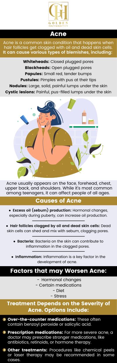 Acne is a common skin disorder that occurs when follicles become clogged with dead skin cells and oil. Acne symptoms vary depending on the severity of the problem and might include whiteheads, blackheads, or cystic lesions. If you are experiencing breakouts from your acne, come to Golden Health Center in Encino, CA, to seek treatment. Dr. Pantea Nikaeen, DC offers treatment for acne and acne scars. For more information, contact us or schedule an appointment online. We are located at 16661 Ventura Blvd Ste 700 Encino, CA 91436. Acne is a common skin disorder that occurs when follicles become clogged with dead skin cells and oil. Acne symptoms vary depending on the severity of the problem and might include whiteheads, blackheads, or cystic lesions. If you are experiencing breakouts from your acne, come to Golden Health Center in Encino, CA, to seek treatment. Dr. Pantea Nikaeen, DC offers treatment for acne and acne scars. For more information, contact us or schedule an appointment online. We are located at 16661 Ventura Blvd Ste 700 Encino, CA 91436.
