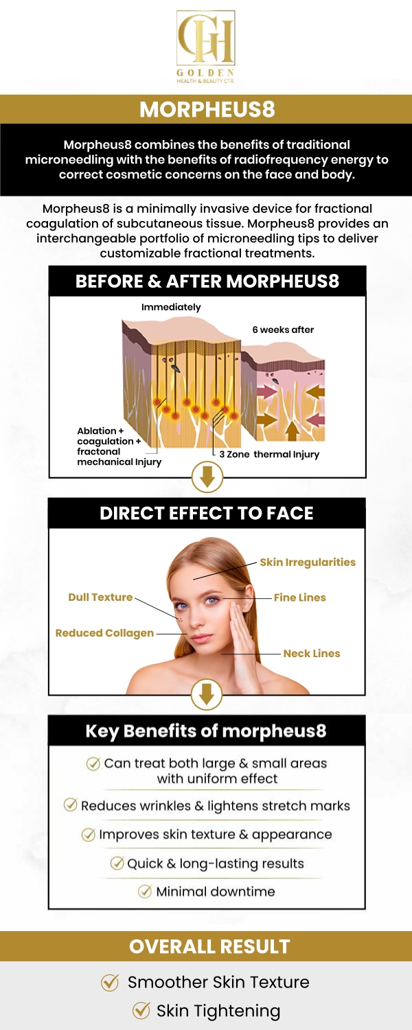 Morpheus8 is a cutting-edge treatment that combines microneedling with radiofrequency (RF) energy to target deep layers of the skin. This powerful combination helps to tighten, lift, and improve the texture of your skin. Visit Dr. Pantea, MD at Golden Health and Beauty Center to achieve a more youthful appearance. For more information, contact us or schedule an appointment online. We are conveniently located at 16661 Ventura Blvd #700, Encino, CA 91436. Morpheus8 is a cutting-edge treatment that combines microneedling with radiofrequency (RF) energy to target deep layers of the skin. This powerful combination helps to tighten, lift, and improve the texture of your skin. Visit Dr. Pantea, MD at Golden Health and Beauty Center to achieve a more youthful appearance. For more information, contact us or schedule an appointment online. We are conveniently located at 16661 Ventura Blvd #700, Encino, CA 91436.