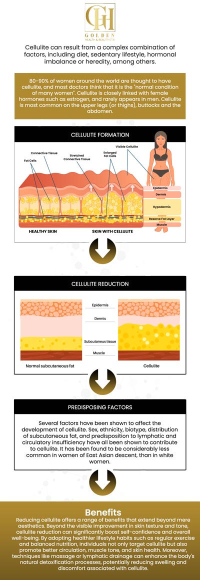 Cellulite reduction treatments help improve skin texture by targeting the dimpled, uneven appearance caused by fat deposits beneath the skin. It develops on the hips, thighs, and buttocks. At Golden Health & Beauty Center, our aesthetic professionals offer effective treatments for cellulite reduction to help you look better and boost your confidence, too. For more information, contact us or schedule an appointment online. We are conveniently located at 16661 Ventura Blvd #700, Encino, CA 91436.